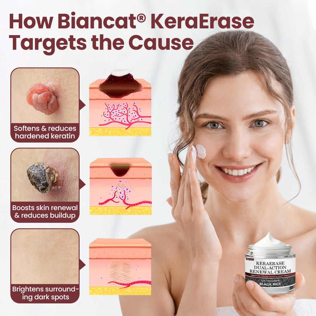 KeraErase® Dual-Action Renewal Cream( Buy 1 Get 1 Free)