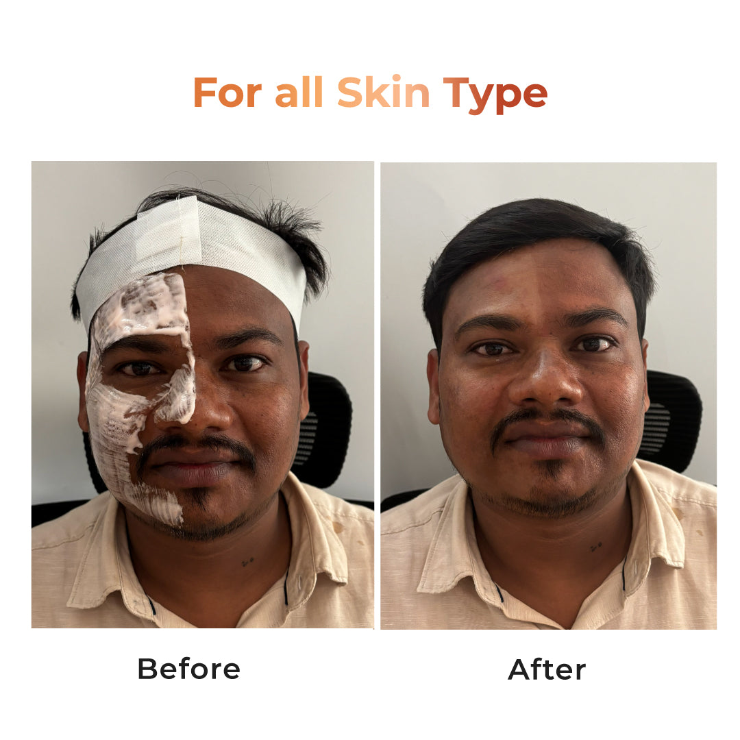 NICONI Tan Vanish Gluta-Kojic Skin Polish Tan Removal