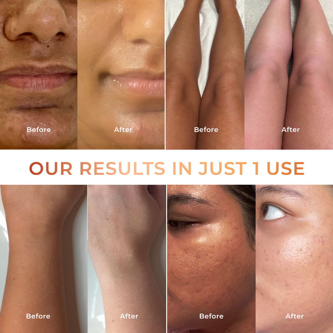 NICONI Tan Vanish Gluta-Kojic Skin Polish Tan Removal